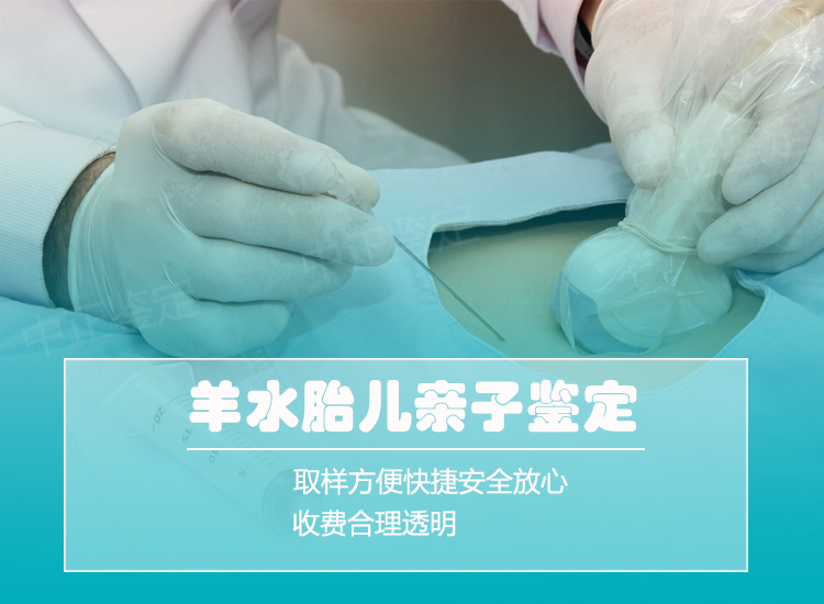 丽水羊水孕期亲子鉴定